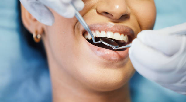 Best Same-Day Emergency Dental Services in Manassas, VA